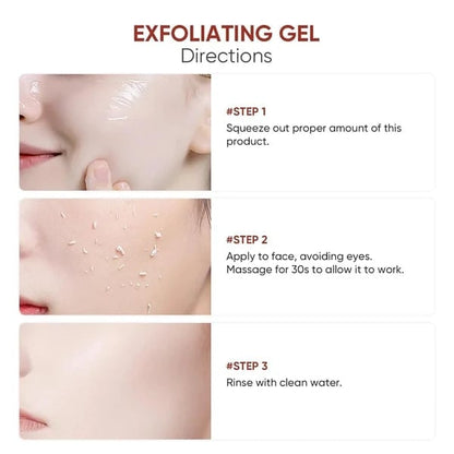 Radiance™ Gentle Peel Gel